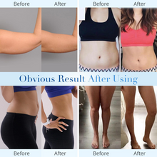 MIA Portable 60k Ultrasonic Cavitation Machine for At-Home Body Contouring