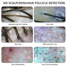 Skin Diagnosis Hair Analyzer