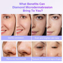 Diamond Microdermabrasion Tips