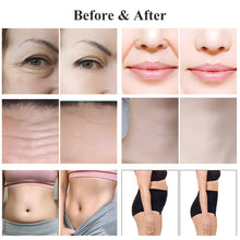 Before and after comparison of facial and body changes, likely related to skincare or cosmetic procedures.