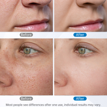 Before and after comparison of skin treatment on a person's face.