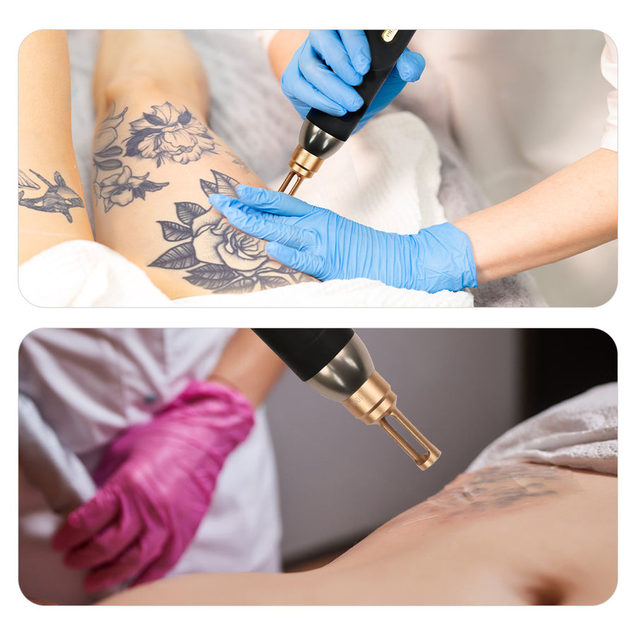 Picosecond Laser Beauty Machine For Tattoo Removal Carbon Facial Peel