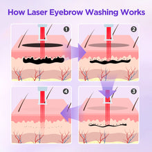 Diagram showing the process of laser eyebrow washing with labeled steps on a purple background.