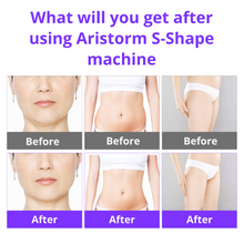 Aristorm 30k S Shape Machine
