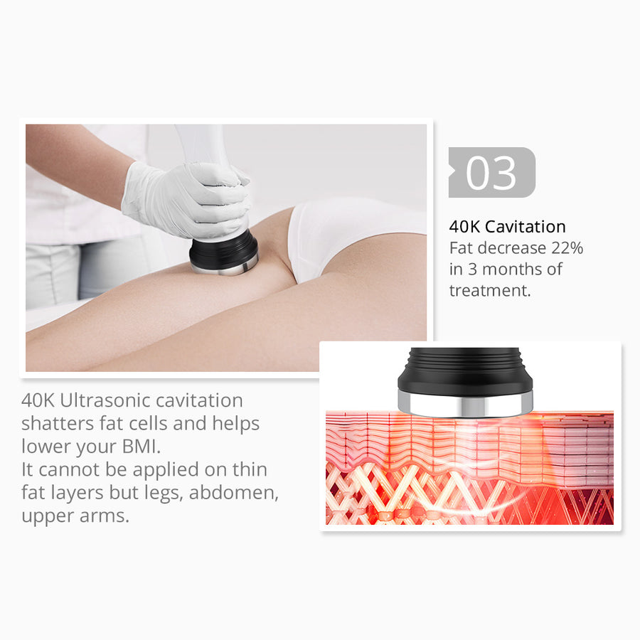 5-in-1 Ultrasonic Cavitation Machine Body Contouring Rotary RF Vacuum