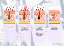 755/808/1064nm Wavelengths Diode Laser Hair Removal Skin Rejuvenation Machine