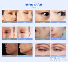 Facial Lifting BIO Microcurrent Therapy Machine Skin Rejuvenation Beauty Machine