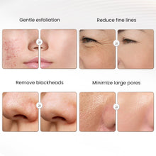 Diamond Microdermabrasion Machine