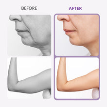 Aristorm 40K Cavitation Machine