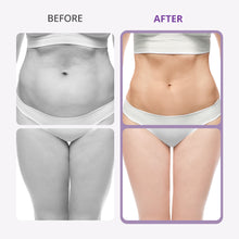 Aristorm 40K Cavitation Machine