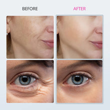 Microcurrent Machine