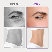 Cavitation Machine for Body Contouring